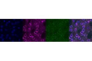 Immunohistochemistry (IHC) image for anti-Kv Channel Interacting Protein 2 (KCNIP2) antibody (ABIN7456313) (KCNIP2 抗体)
