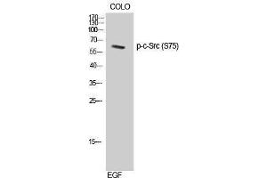 Western Blotting (WB) image for anti-Proto-oncogene tyrosine-protein kinase Src (Src) (pSer75) antibody (ABIN3182677) (Src 抗体  (pSer75))