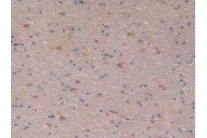 IHC-P analysis of Human Brain Tissue, with DAB staining. (NFkB 抗体  (AA 805-892))