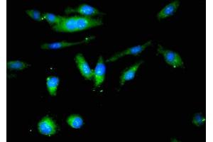 Immunofluorescent analysis of Hela cells using ABIN7147632 at dilution of 1:100 and Alexa Fluor 488-congugated AffiniPure Goat Anti-Rabbit IgG(H+L) (Butyrylcholinesterase 抗体  (AA 311-524))