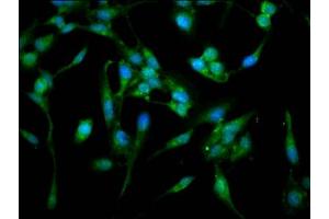 Immunofluorescence staining of Hela cells with ABIN7143093 at 1:100, counter-stained with DAPI. (ARPC4 抗体  (AA 2-168))