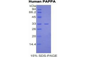 SDS-PAGE analysis of Human PAPPA Protein. (PAPPA 蛋白)
