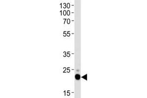 Western blot analysis of lysate from HeLa cell line using CD9 antibody. (CD9 抗体  (AA 115-145))