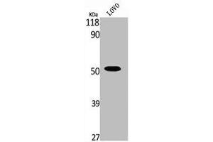 Western Blot analysis of LOVO cells using Phospho-MOR-1 (S375) Polyclonal Antibody (Mu Opioid Receptor 1 抗体  (pSer375))