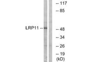 Western blot analysis of extracts from Jurkat cells, using LRP11 Antibody. (LRP11 抗体  (AA 48-97))