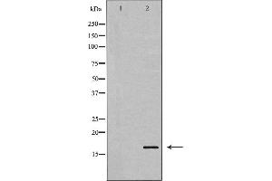Western blot analysis of Stathmin 1 expression in Jurkat cells. (Stathmin 1 抗体  (N-Term))