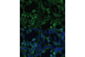 Immunofluorescence analysis of NIH-3T3 cells using EIF1AX Polyclonal Antibody (ABIN6131999, ABIN6140017, ABIN6140018 and ABIN6221620) at dilution of 1:100 (40x lens).