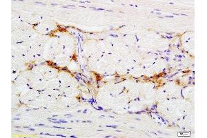 Formalin-fixed and paraffin embedded rat tongue tissue labeled with Anti-CD47/MER6 Polyclonal Antibody, Unconjugated  at 1:200 followed by conjugation to the secondary antibody (CD47 抗体  (AA 241-323))