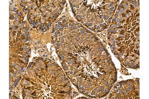 ABIN7094361 and ABIN7098408 at 1/100 staining Mouse testis tissue by IHC-P. (MIPEP 抗体  (C-Term))
