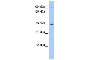 ODF2 antibody used at 1 ug/ml to detect target protein. (ODF2 抗体  (N-Term))