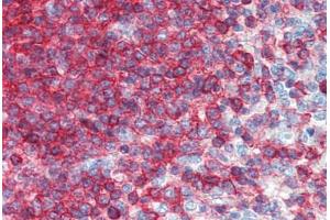 Human Spleen (formalin-fixed, paraffin-embedded) stained with CD44 antibody ABIN396970 at 5 ug/ml followed by biotinylated anti-mouse IgG secondary antibody ABIN481714, alkaline phosphatase-streptavidin and chromogen. (CD44 抗体)