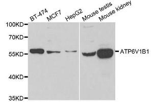 Western blot analysis of extracts of various cell lines, using ATP6V1B1 antibody. (ATP6V1B1 抗体  (AA 1-280))