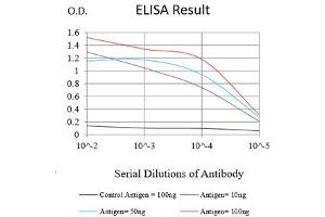 Black line: Control Antigen (100 ng),Purple line: Antigen (10 ng), Blue line: Antigen (50 ng), Red line:Antigen (100 ng) (ADAM10 抗体)