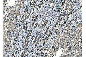 IHC analysis of NEDD4 using anti-NEDD4 antibody (ABIN7599536).