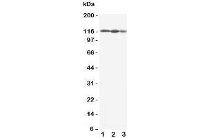 Western blot testing of EIF3B antbody; Lane 1: HeLa;  2: 293T;  3: A431 cell lysate. (EIF3B 抗体  (C-Term))