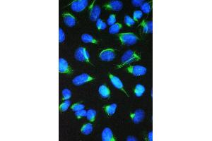 IF analysis of CCT7 using anti-CCT7 antibody (ABIN5692966). (CCT7 抗体  (AA 30-307))