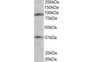 Western Blotting (WB) image for anti-ELKS/RAB6-Interacting/CAST Family Member 1 (ERC1) (N-Term) antibody (ABIN2465645) (ERC1 抗体  (N-Term))