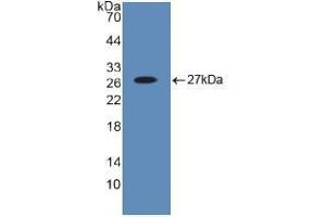 Western blot analysis of recombinant Human Bid. (BID 抗体  (AA 1-195))