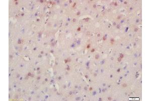 Formalin-fixed and paraffin embedded rat brain labeled with Rabbit Anti-BRD8 Polyclonal Antibody, Unconjugated (ABIN716951) at 1:200 followed by conjugation to the secondary antibody and DAB staining (BRD8 抗体  (AA 331-430))