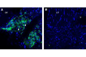 Immunohistochemical staining of perfusion-fixed frozen rat brain sections using Anti-SLC36A1 (PAT1) Antibody (ABIN7885483), (1:300), followed by goat anti-rabbit-.