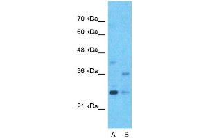 Host:  Rabbit  Target Name:  M96  Sample Type:  Hela  Lane A:  Primary Antibody  Lane B:  Primary Antibody + Blocking Peptide  Primary Antibody Concentration:  1ug/ml  Peptide Concentration:  5ug/ml  Lysate Quantity:  25ug/lane/lane  Gel Concentration:  0. (MTF2 抗体  (Middle Region))