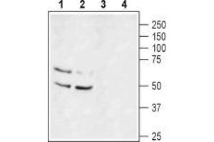 Western blot analysis of rat brain lysate (lanes 1 and 3) and mouse brain lysate (lanes 2 and 4): - 1,2. (KCNA1 抗体  (1st Extracellular Loop))