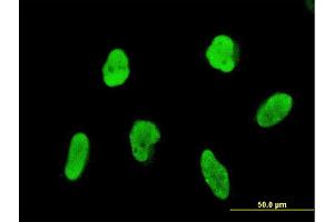 Immunofluorescence of monoclonal antibody to FLI1 on HeLa cell. (FLI1 抗体  (AA 1-452))