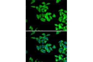 Immunofluorescence analysis of A-549 cells using NMT2 antibody (ABIN6130572, ABIN6144688, ABIN6144690 and ABIN6222825). (NMT2 抗体  (AA 1-120))