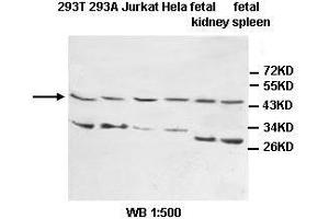 Image no. 1 for anti-Interleukin 1 Receptor, Type II (IL1R2) antibody (ABIN1577241) (IL1R2 抗体)