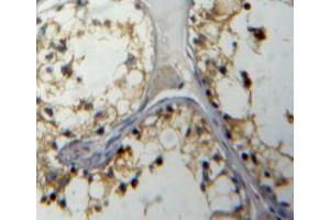 Used in DAB staining on fromalin fixed paraffin-embedded testis tissue (IL5RA 抗体  (AA 42-182))