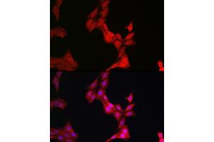 Immunofluorescence analysis of PC-12 cells using Glucocorticoid Receptor Rabbit pAb (ABIN3023090, ABIN3023091, ABIN3023092, ABIN1513281 and ABIN6219384) at dilution of 1:200 (40x lens). (Glucocorticoid Receptor 抗体  (AA 1-280))
