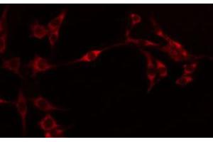 ABIN6274595 staining Hela by IF/ICC. (OB Cadherin 抗体  (Internal Region))