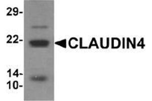 Western blot analysis of CLAUDIN4 in human colon tissue lysate with CLAUDIN4 Antibody  at 1 μg/ml. (Claudin 4 抗体  (C-Term))