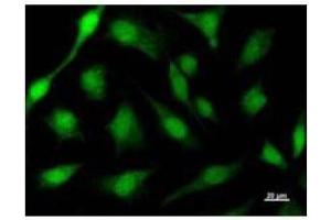 Immunostaining analysis in HeLa cells. (ACIN1 抗体)