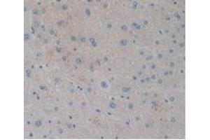 Detection of CCK8 in Human Liver Tissue using Monoclonal Antibody to Cholecystokinin 8 (CCK8) (CCK8 抗体)