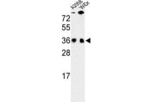 Western Blotting (WB) image for anti-serine/arginine-Rich Splicing Factor 1 (SRSF1) antibody (ABIN3002837) (SRSF1 抗体)