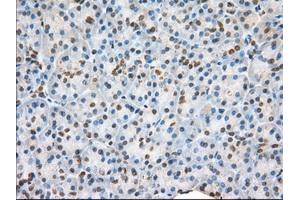 Immunohistochemical staining of paraffin-embedded liver tissue using anti-H6PD mouse monoclonal antibody. (Glucose-6-Phosphate Dehydrogenase 抗体)