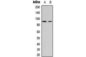 Western blot analysis of SP1 (pT453) expression in Jurkat (A), mouse melanoma cancer (B) whole cell lysates.