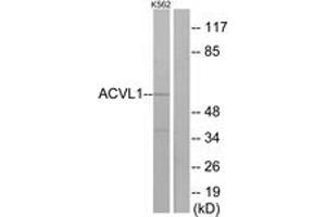 Western blot analysis of extracts from K562 cells, using ACVL1 Antibody. (ACVRL1 抗体  (AA 196-245))