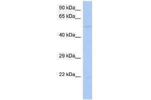 WB Suggested Anti-RIPK3 Antibody Titration:  0. (RIPK3 抗体  (Middle Region))