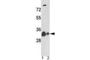 Western blot analysis of VDAC antibody and 1) human A375 cell line and 2) mouse heart tissue lysate. (VDAC1 抗体  (AA 1-30))