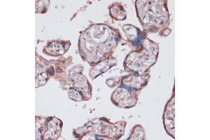 Immunohistochemistry of paraffin-embedded human placenta using RPS13 antibody (ABIN7270012) at dilution of 1:100 (40x lens). (RPS13 抗体  (AA 79-151))