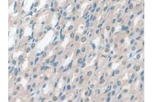 DAB staining on IHC-P; Samples: Rat Stomach Tissue (GSTM4 抗体  (AA 21-215))