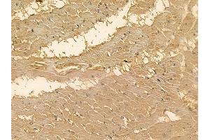 MRS2 Mouse Monoclonal Antibody at 1/100 staining rat heart tissue by IHC-P. (MRS2 抗体)
