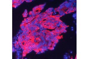 IF analysis of Cytokeratin 19 using anti-Cytokeratin 19 antibody (ABIN5693023). (Cytokeratin 19 抗体  (C-Term))