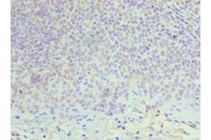 Immunohistochemistry of paraffin-embedded human tonsil tissue using ABIN7150339 at dilution of 1:100 (MCM6 抗体  (AA 562-821))