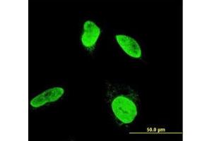Image no. 3 for anti-Testis-Specific Kinase 2 (TESK2) (AA 405-542) antibody (ABIN599135) (TESK2 抗体  (AA 405-542))