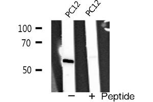 Western blot analysis of TRAF2 expression in PC12 cells (TRAF2 抗体  (C-Term))