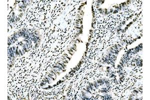IHC analysis of ADAR1/ADAR using anti-ADAR1/ADAR antibody (ABIN7598956). (ADAR 抗体  (AA 1-1152))