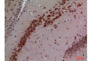 Immunohistochemistry (IHC) image for anti-Cullin 4B (CUL4B) (Internal Region) antibody (ABIN3187726)